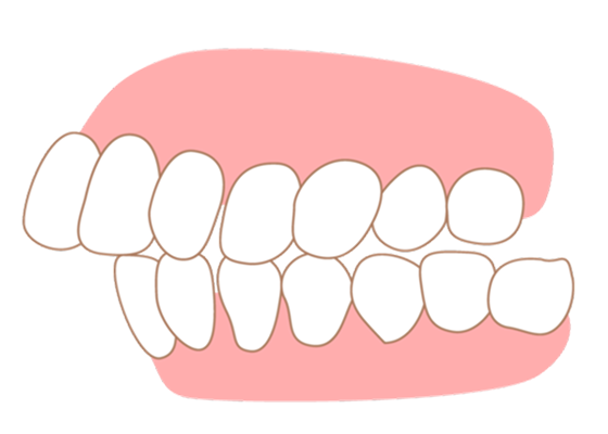correction_teeth01