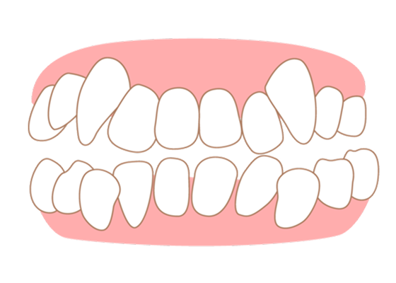 correction_teeth02