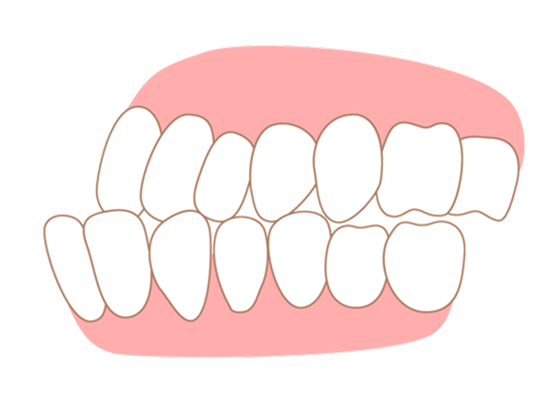 correction_teeth04